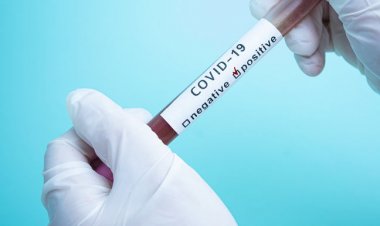 How Can I Test for COVID-19?